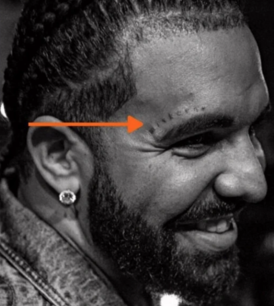 drake in yuzune yaptirdigi miskin dovmesi gundem oldu